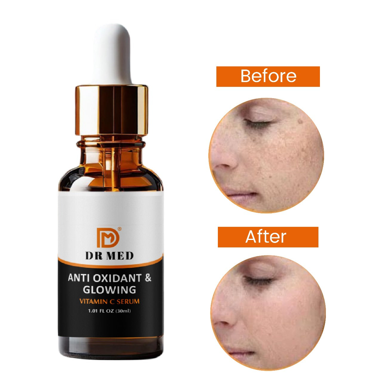 DR MED Vitamin C serum Radiance: Unlock Radiant Skin with our Anti-Oxidant & Glowing Vitamin C Serum (1.01 FL OZ/30ml) -