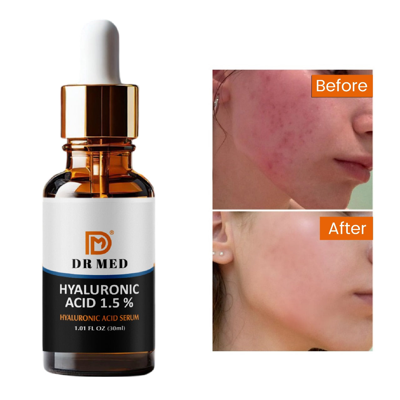 DR MED Hyaluronic Acid Serum for Face - Deeply Hydrates, Reduces Wrinkles, and Improves Skin Texture - 30 ML