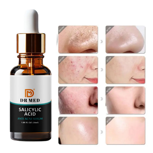 "DR MED Salicylic Acid Anti-Acne Serum: Combat Breakouts and Achieve Clear, Radiant Skin"