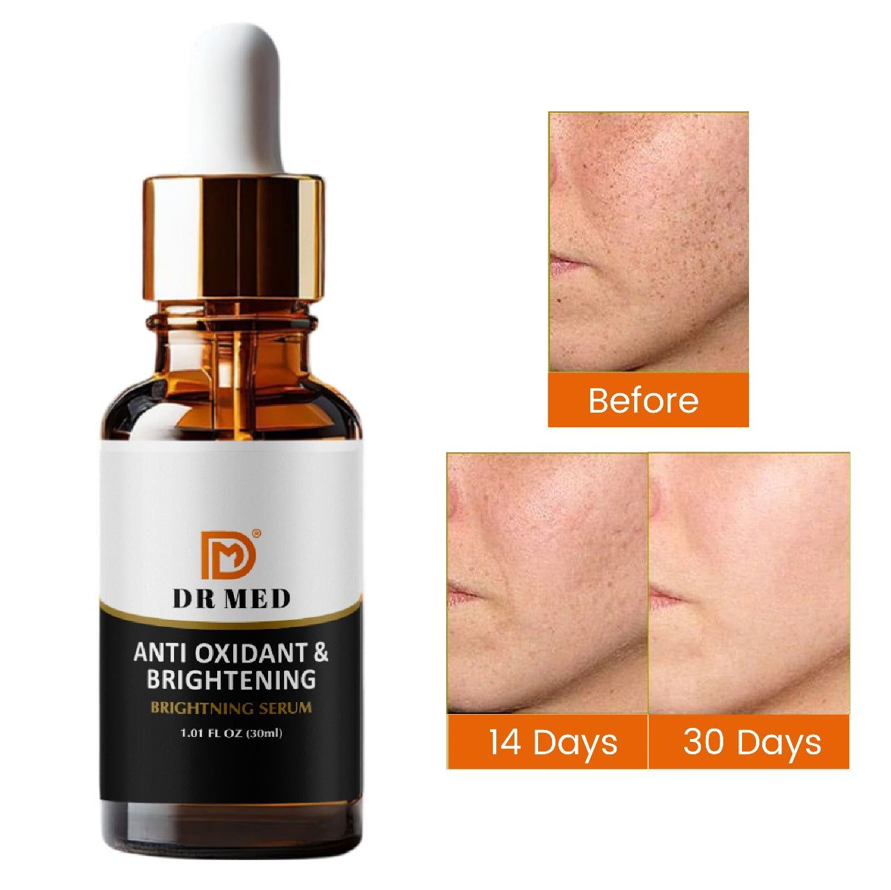 DR MED Brightening Serum for Face Dark Spot Reduction, Even Skin Tone (30ml)